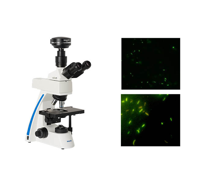 生殖疾病显微镜.jpg 生殖疾病显微镜.jpg