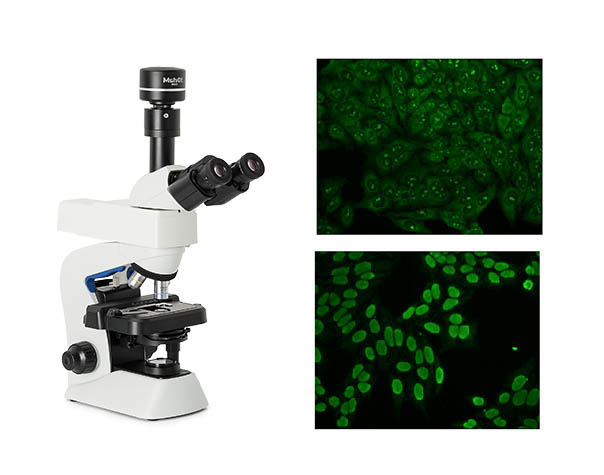 自身免疫显微镜.jpg 自身免疫显微镜.jpg