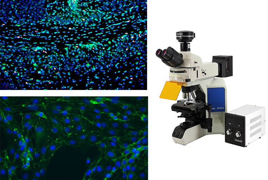 正置荧光显微镜.jpg 正置荧光显微镜.jpg