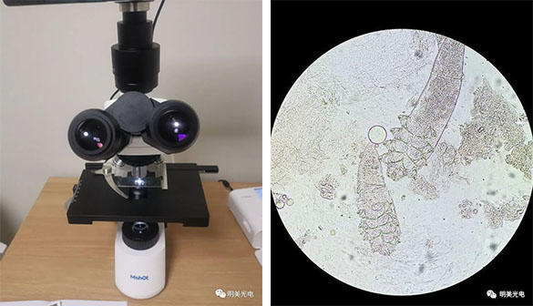 正置显微镜-螨虫.jpg 正置显微镜-螨虫.jpg