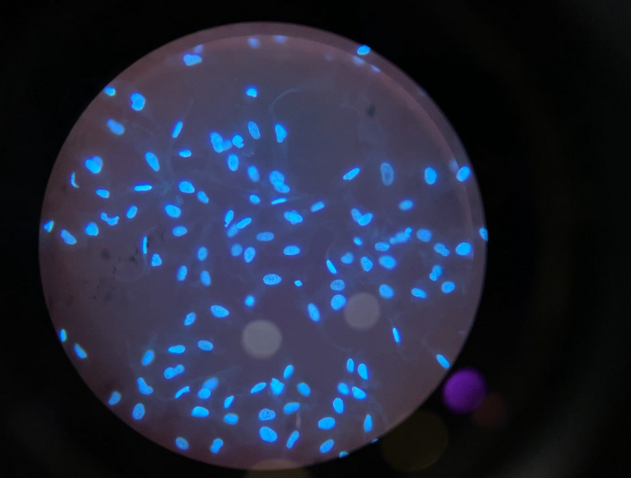 BG_Fluo_09.jpg BG_Fluo_09.jpg