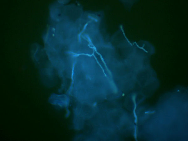 皮肤真菌皮屑_MF23-M+MD50-T_202310_北京中医药大学深圳医院（龙岗）皮肤科（快速检查真菌感染）_4.jpg