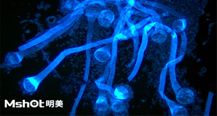 荧光显微成像系统在定性检测结核杆菌及真菌的应用