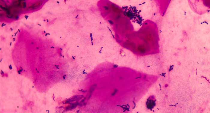 明美显微镜相机应用于细菌样品的成像