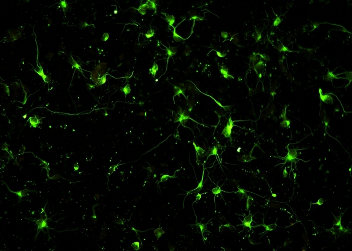 光学显微镜可以观察到神经细胞吗？荧光显微镜可以
