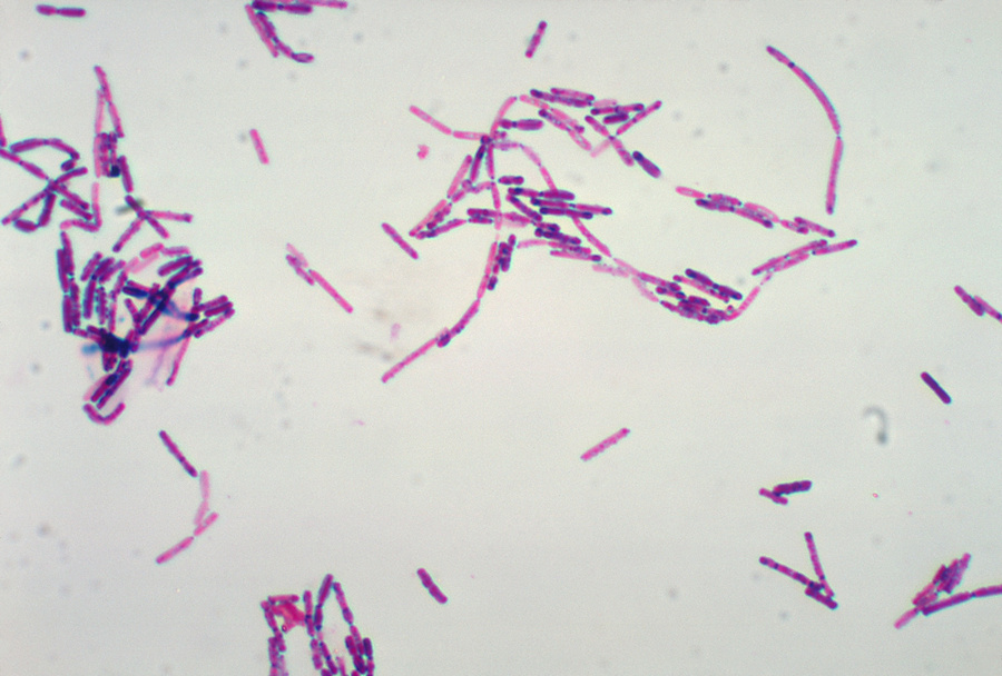 显微镜下的芽孢杆菌|应用百科