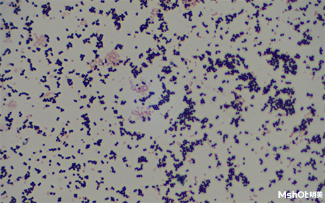 荧光显微镜在细菌筛查中的应用