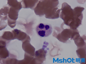 3血液中的白细胞观察的重要工具—广州明美自主研发的显微镜相机MD50.jpg