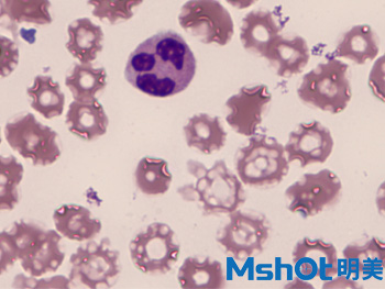 2血液中的白细胞观察的重要工具—广州明美自主研发的显微镜相机MD50.jpg