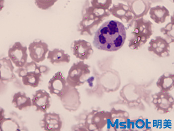 1血液中的白细胞观察的重要工具—广州明美自主研发的显微镜相机MD50.jpg