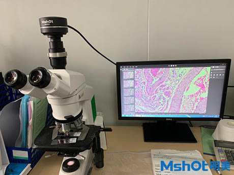 明美显微镜相机MS60应用于病理切片检验1.jpg