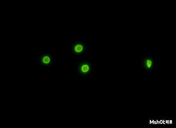 荧光显微镜下隐孢子虫.jpg