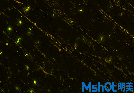 荧光显微成像系统在定性检测结核杆菌及真菌的应用1.jpg