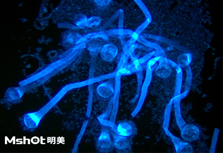 荧光显微成像系统在定性检测结核杆菌及真菌的应用2.jpg
