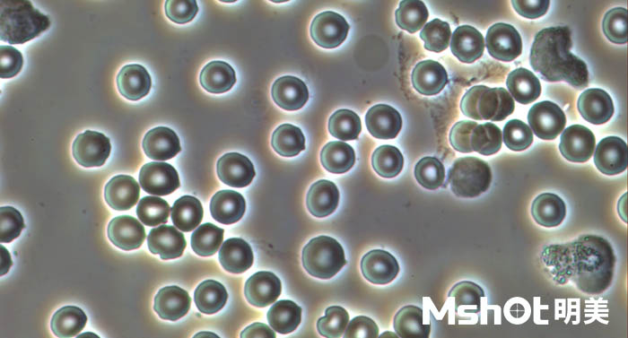 观察实时动态的血细胞用什么显微镜看？