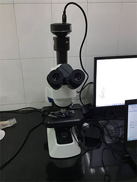 明美生物荧光显微镜助力华中科大校医院真菌检测
