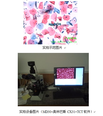明美成像系统MD30用于TCT液基细胞分析.jpg