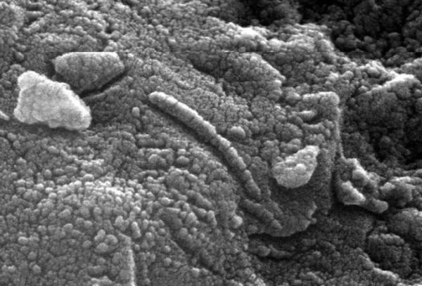 读者问：我想看火星微生物，用显微镜可以吗？
