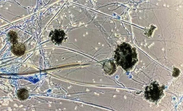 比新冠更恐怖的“黑毛霉菌”，在荧光显微镜下长啥样？