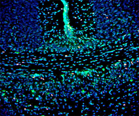 荧光显微镜用于小鼠荧光脑片观察