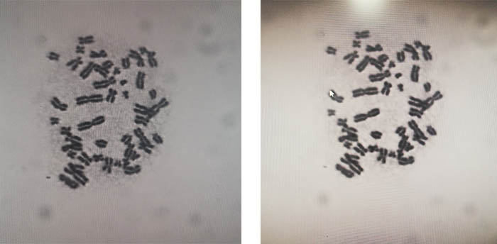 明美黑白显微镜相机用于染色体观察