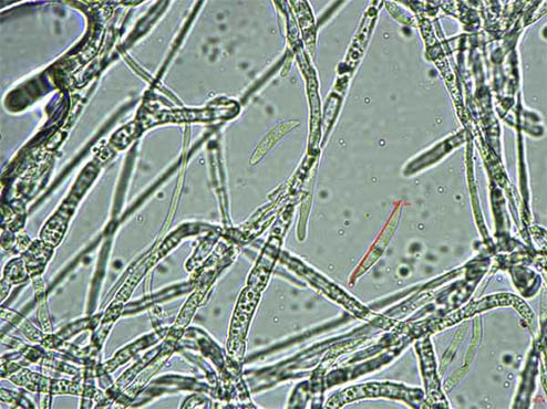 霉菌图片大全显微镜图片