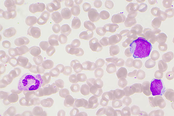 荧光显微镜下的血液细胞.jpg