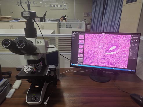 明美生物显微镜用于病理切片观察