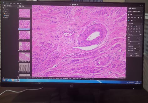 生物显微镜下的组织切片.jpg