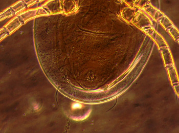 倒置显微镜下看清螨虫的真面目