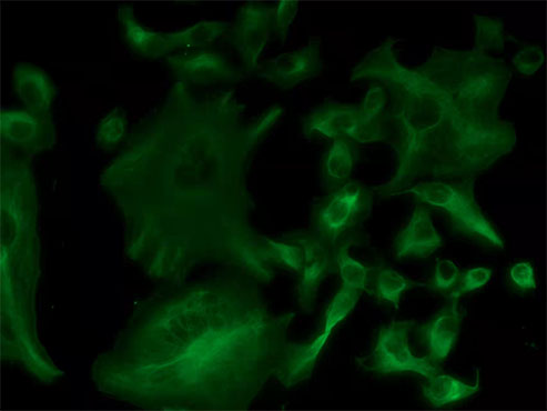 倒置荧光显微镜下的染色细胞2.jpg