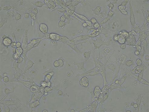 倒置荧光显微镜下的细胞图2.jpg