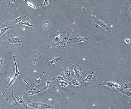 倒置显微镜下的海拉细胞3.jpg
