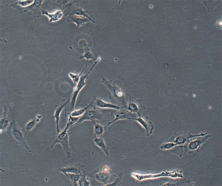 倒置显微镜下的海拉细胞1.jpg