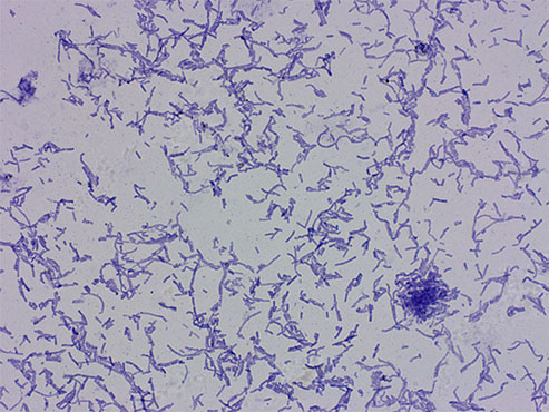 显微镜相机拍摄保存的细菌2.jpg