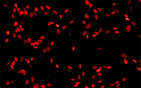 MF43下的荧光细胞1.jpg