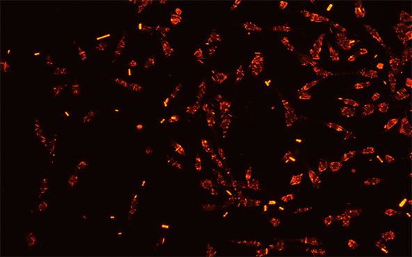 倒置荧光显微镜下的免疫细胞1.jpg