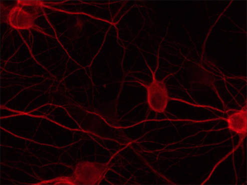 神经元荧光成像.jpg