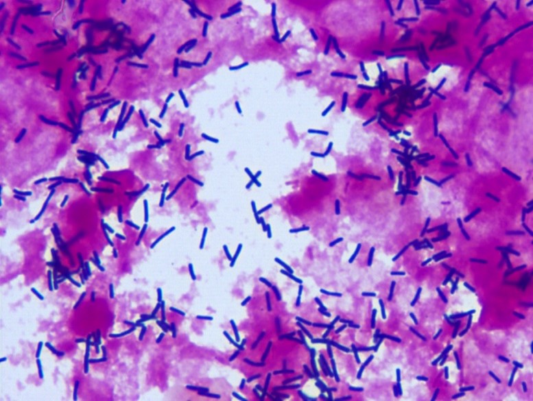 明美显微镜相机下的染色细菌