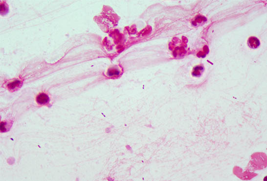 显微镜相机下的细菌.jpg