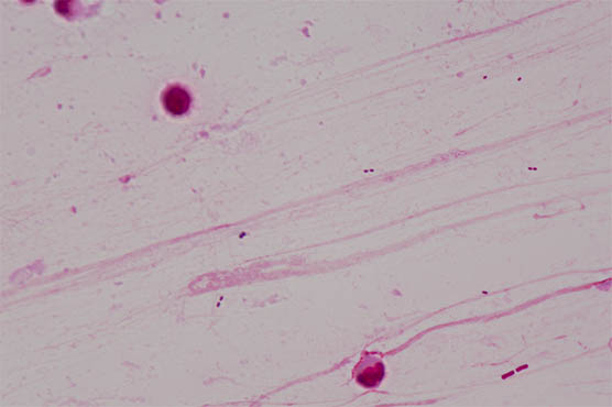 显微镜相机下的细菌1.jpg