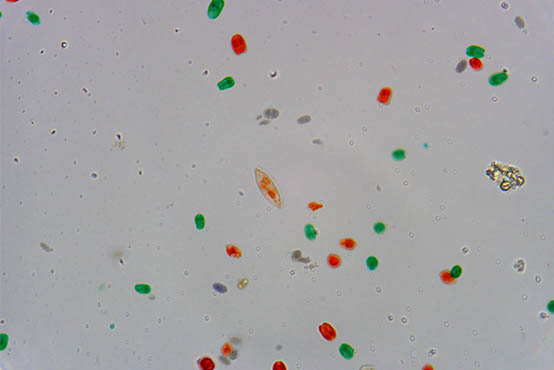 显微镜下的酵母菌.jpg