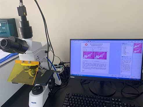 明美荧光显微镜助力佛山南海区人民医院真菌检测