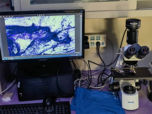 明美生物显微镜为ICU观察提供准确清晰的病理图像