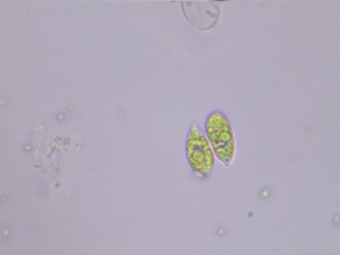 生物显微镜ML51-N下的绿藻（榄形）.jpg