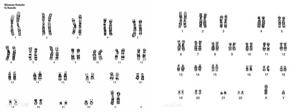 染色体核型图.jpg