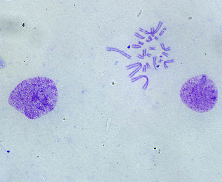 染色体核型分析镜检用什么显微镜