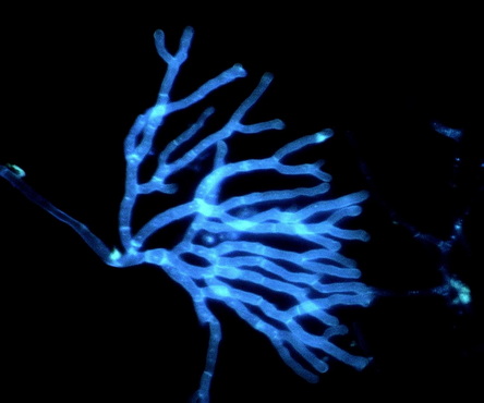 荧光生物显微镜助力前海人寿韶关医院皮屑真菌检测