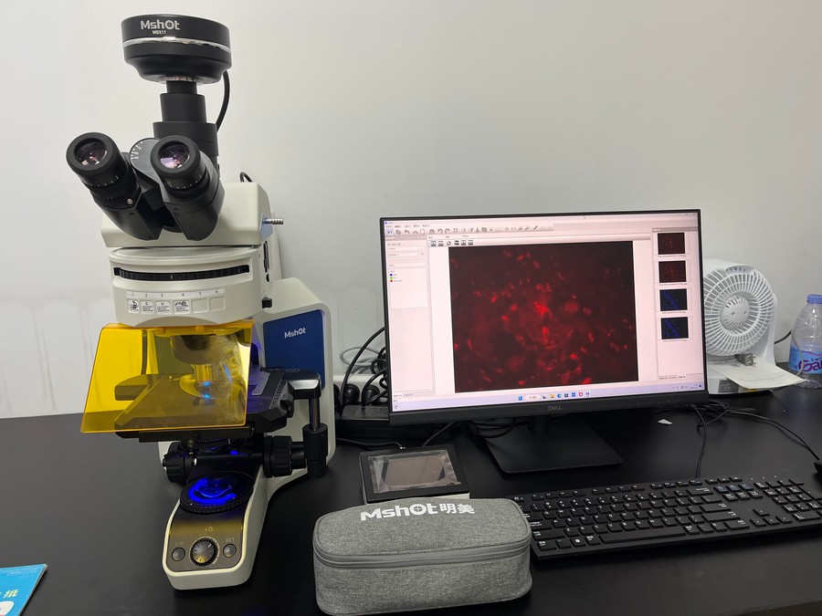 研究级荧光显微镜观察FISH膀胱癌