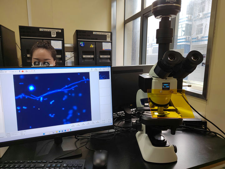 荧光生物显微镜在皮肤真菌观察中的应用